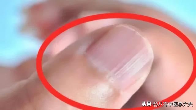 脸上有黑点，胸口针扎一样疼，眼圈发黑，嘴唇发黑，是瘀血造成的