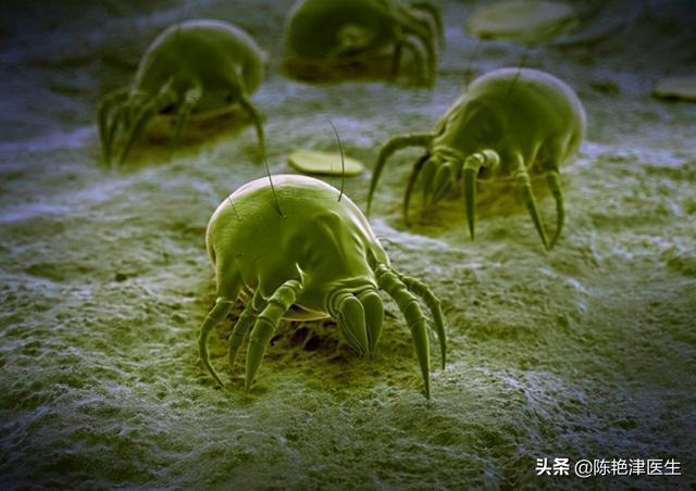 硫磺乳涂了4天身体还痒