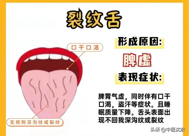 中医：从舌头看健康，舌象分析，常见的6种舌苔问题！和调理建议