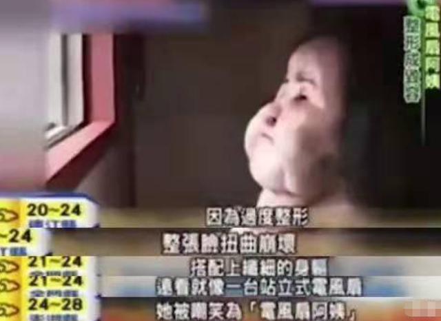2018年韩慧景去世，年轻时在脸上注射色拉油，因整容过度几乎毁容