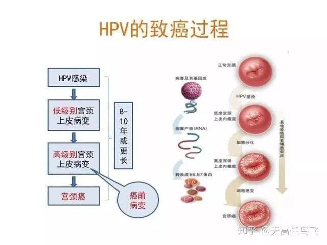 感染HPV了，會得宮頸癌嗎？