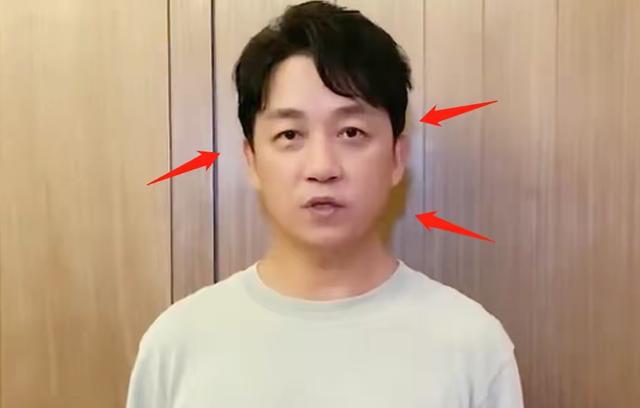 鹿晗浮肿到快睁不开眼，罗志祥苹果肌飞起，男明星状态太糟糕