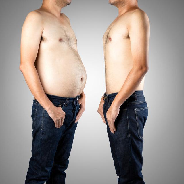 鳞状上皮角化珠