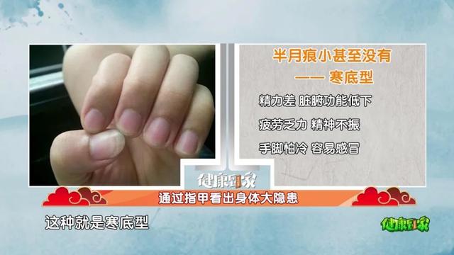 手指甲满足3个特点，多半是身体在“求救”！赶紧自测