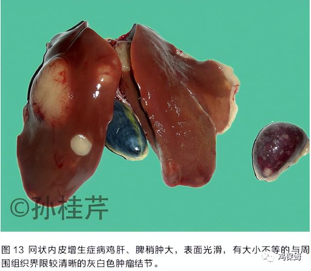 鸡皮肤是不传染
