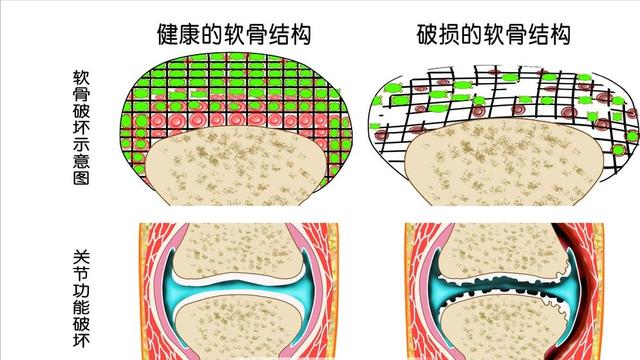 老年人下肢无力，有常见5个原因，该怎样预防和应对，医生告诉您