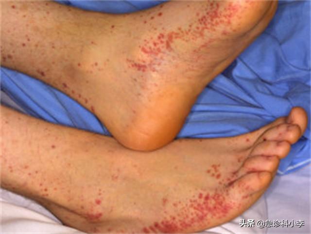 胳膊上好多小红点