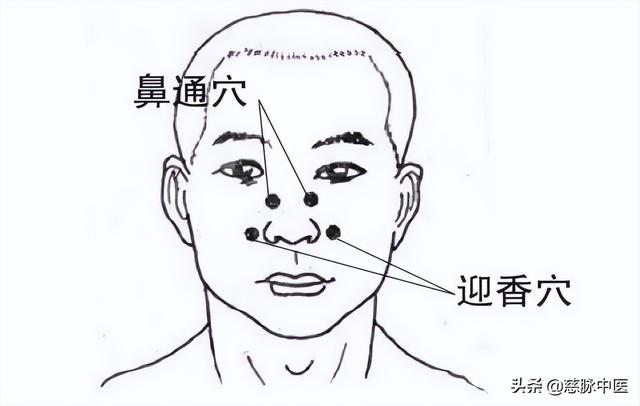 鼻炎别当感冒，该治还得治