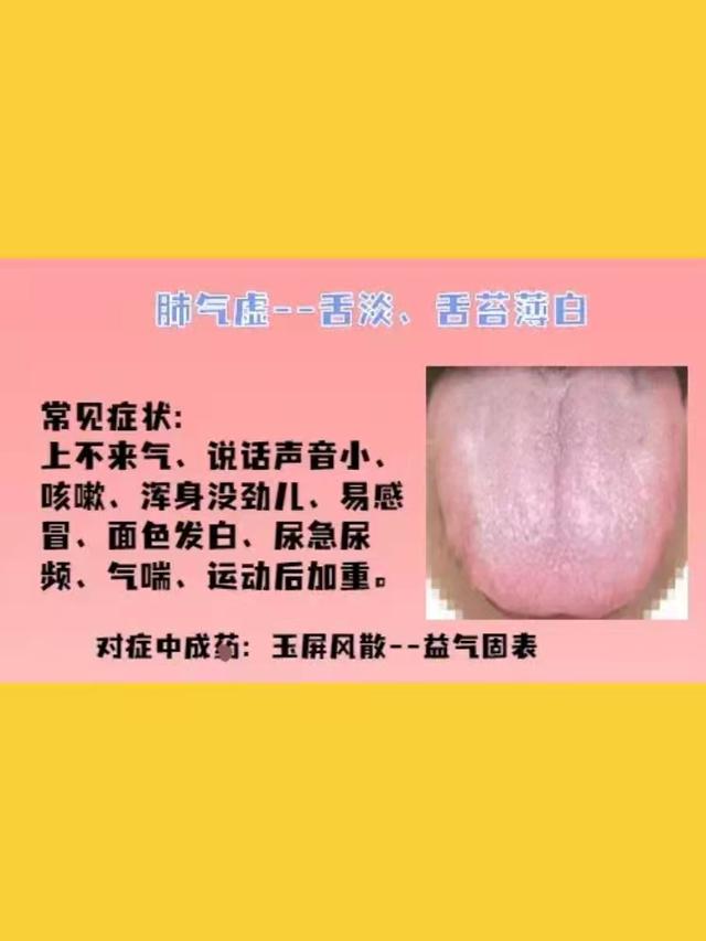 身体常见的几种虚证，建议了解