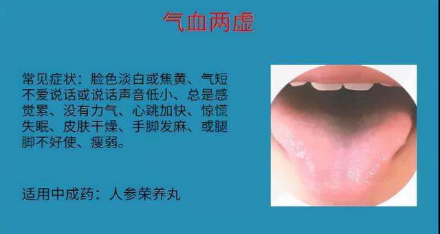 怕冷就补阳？血虚也会！6种血虚情况，实用中成药大总结