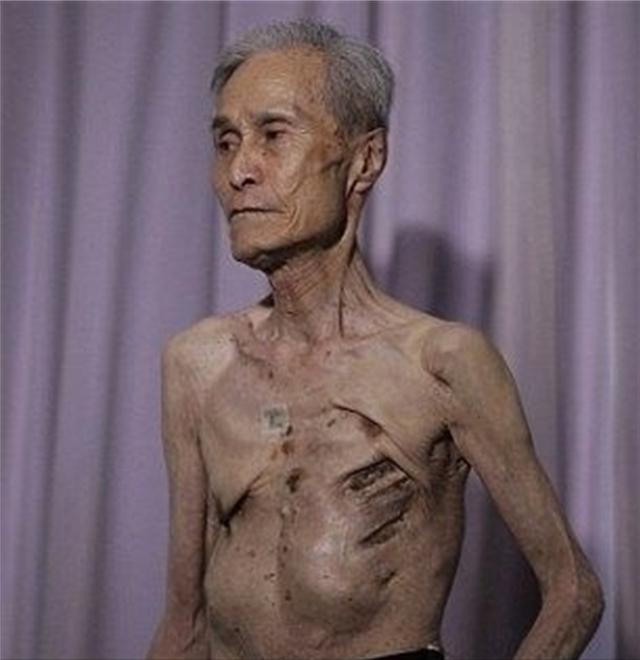 原子弹爆炸时应该如何逃生？日本当年幸存者说出实情，千万别跳水