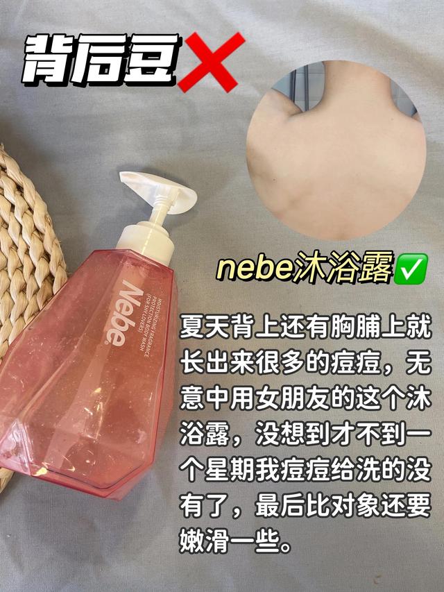 上海硫磺皂可以祛鸡皮肤吗