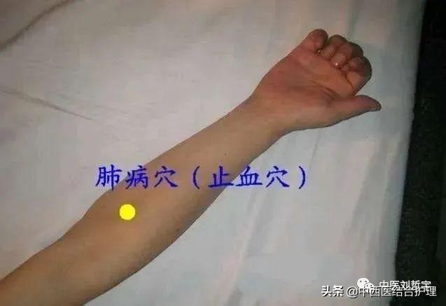 「穴位养生」上肢部常用平衡穴位（共11穴），超使用哦