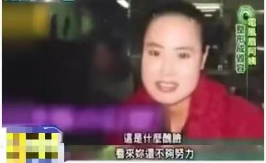 韩慧景：把自己整成“电风扇”，注射食用油代价惨痛，我悔不当初