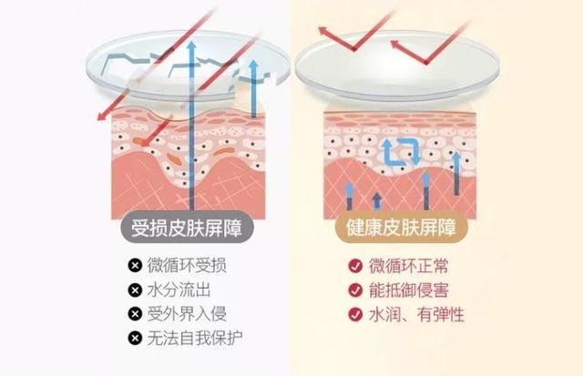 鳞雪角化型脚气