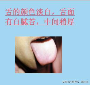 临床常见的9种舌象，对照自测