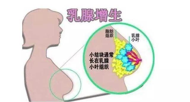 乳腺增生中医治疗方法汇总