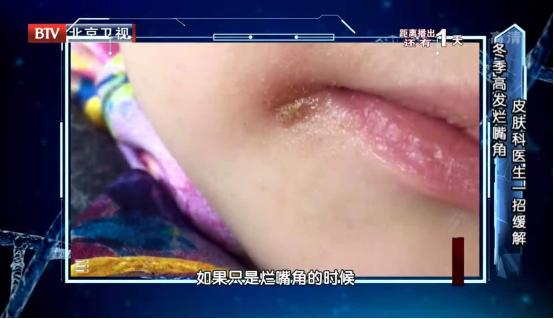 这7个习惯赶紧改，可能诱发"致命危机"！看完才知道有多危险…