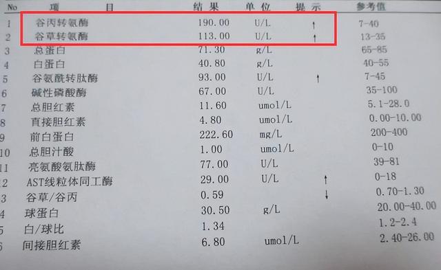 转氨酶高，不能吃“西瓜”？医生：少碰5果，摒弃2习，肝或感激你