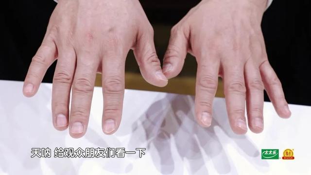 手指甲满足3个特点，多半是身体在“求救”！赶紧自测