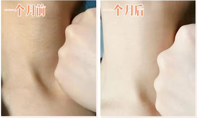 鸡皮肤哪个牌子好