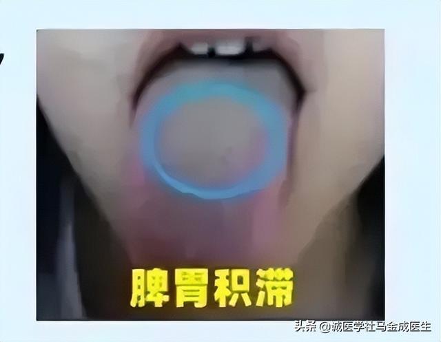 常用调理脾胃的中成药应用大全，不下十几种，看看怎么区分？