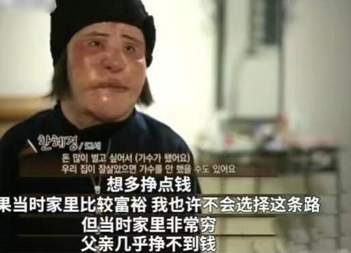 韩慧景：把自己整成“电风扇”，注射食用油代价惨痛，我悔不当初