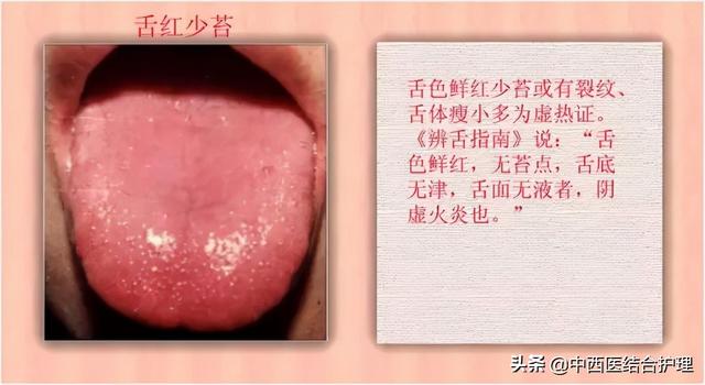 「舌诊科普」中医医生总看舌头都在看什么？奉上珍贵的舌诊图谱