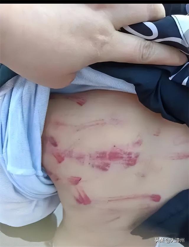 停职！警方介入