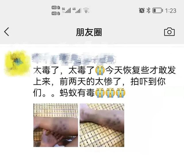 红火蚁再伤人！广西一女子被咬伤！伤势严重！被咬了该怎么办？