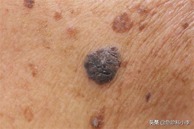 胳膊上好多小红点