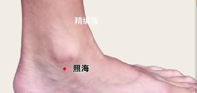 “八脉交汇穴”照海穴——调理咽喉炎、失眠和眼疾