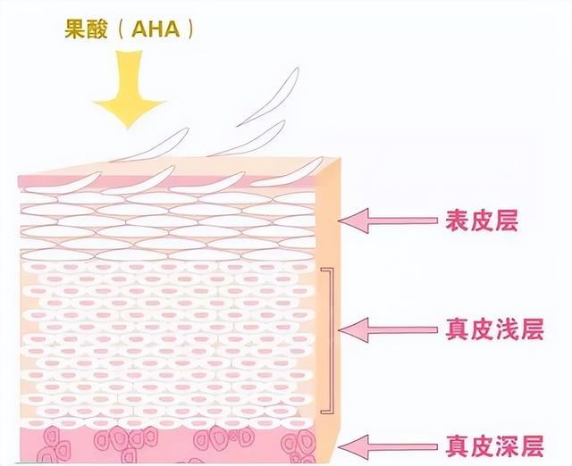 怎样临时快速遮盖纹身