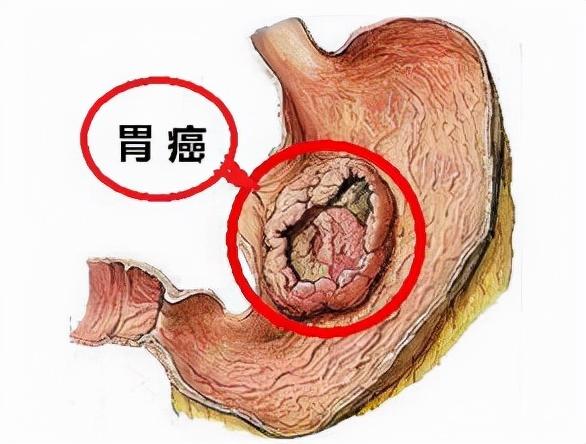 喝酒真的不能吃花生米吗？提醒：3种食物尽量不要做下酒菜