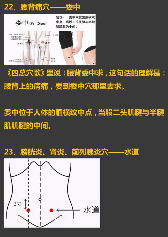 30个常见疾病特效穴位大全，超级实用的中医知识，收藏起来吧