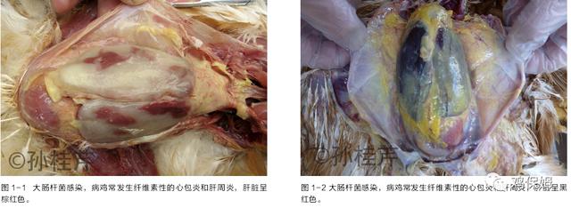 鸡皮肤是不传染