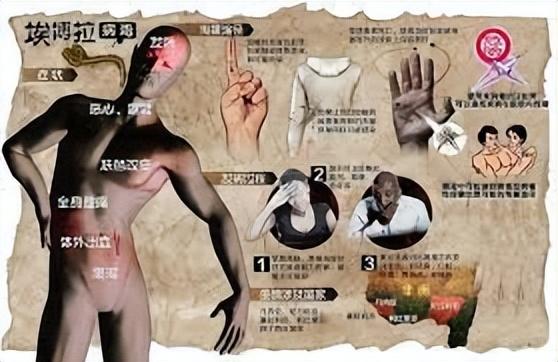突发：刚果（金）发现一埃博拉确诊病例，新一轮埃博拉疫情爆发？
