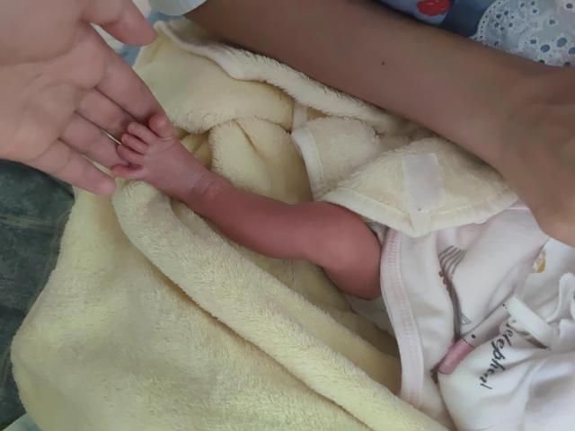 吐了整个孕期的闺蜜，小孩36+4出生了