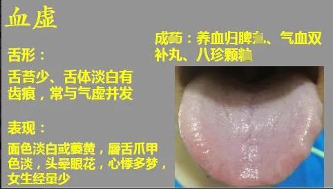身体常见的几种虚证，建议了解