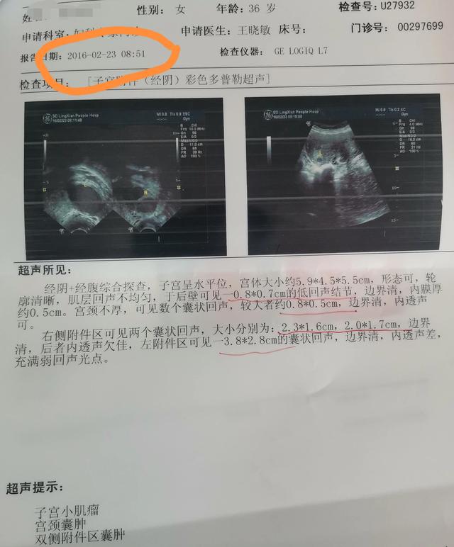 一位大龄妈妈为了要个二胎宝宝的心路历程