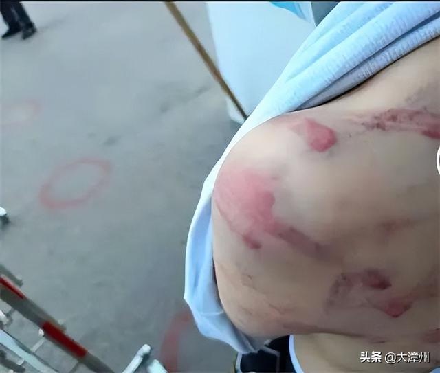 停职！警方介入