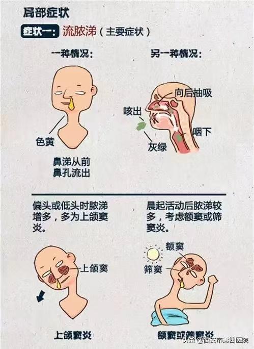 孩子反复咳嗽、鼻塞、流脓性鼻涕，以为是“感冒”？ 这都是鼻窦炎惹的祸！