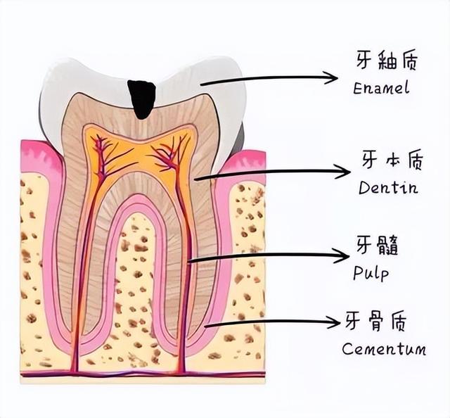 牙齿上有黑色的东西洗不掉怎么办