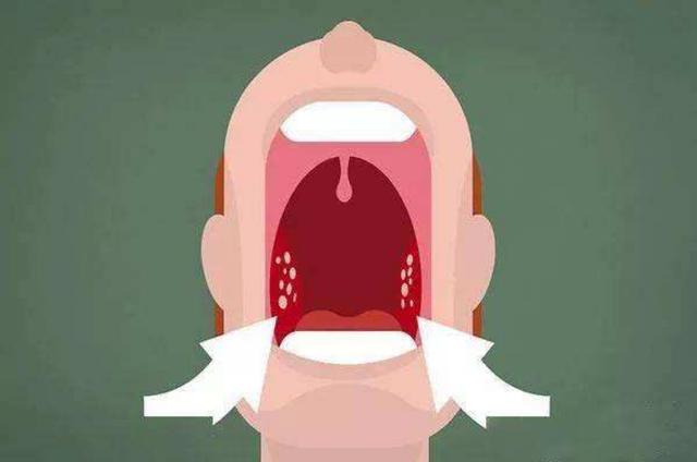 孩子腺样体肥大，根源在这2处，会产生3大方面危害