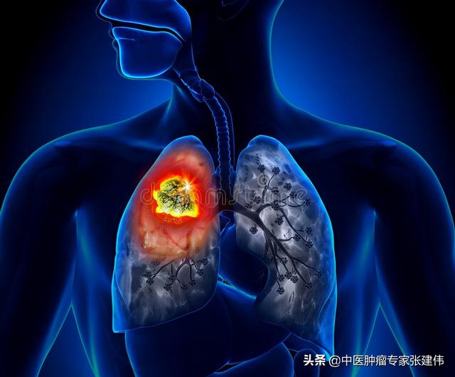 別把咳嗽不當回事，這5種咳嗽不普通，可能是肺癌在“報警”