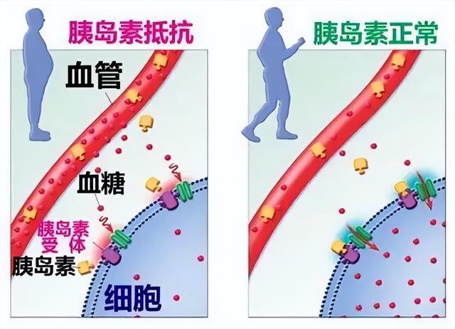 高血压服药十年，却查出肾衰竭，这位患者的3点错误，值得反思
