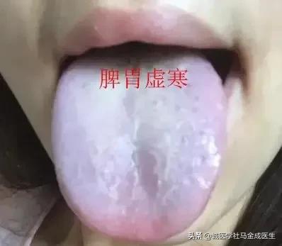 一吃凉的就胃痛？教你几个中成药，让你冷热酸甜，想吃就吃