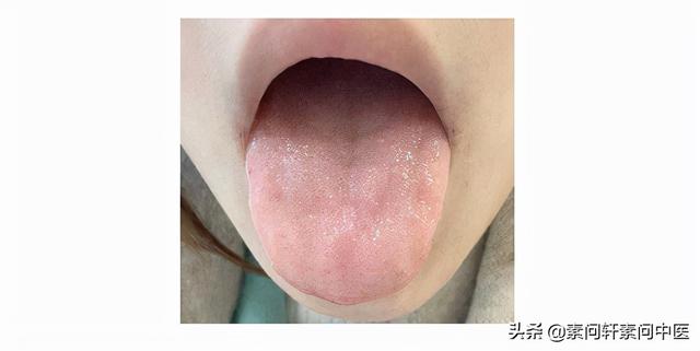 这个春菜大量上市：暖胃补肾，但这6种情况不要多吃哦