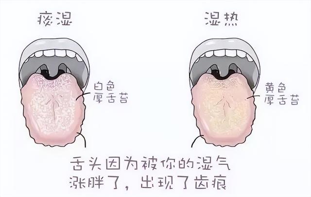 到底是先健脾还是先祛湿？看完这个，你就明白祛湿的先后顺序了