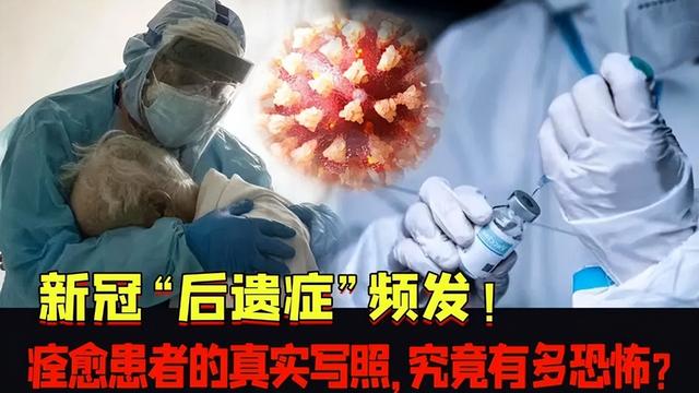 新冠轻度患者也有“后遗症”？调查万余人，这4种症状很常见